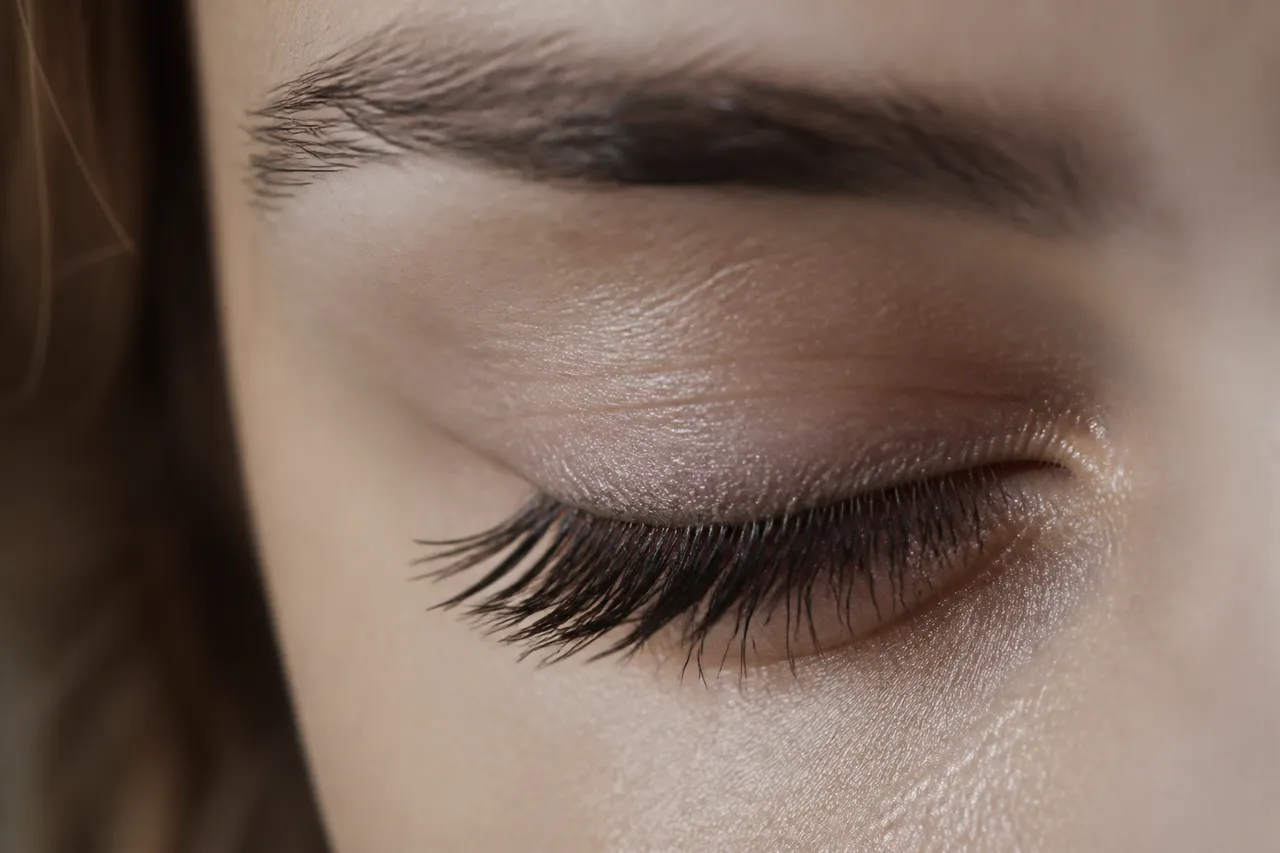 Distichiasis : double rangée de cils sur la paupière