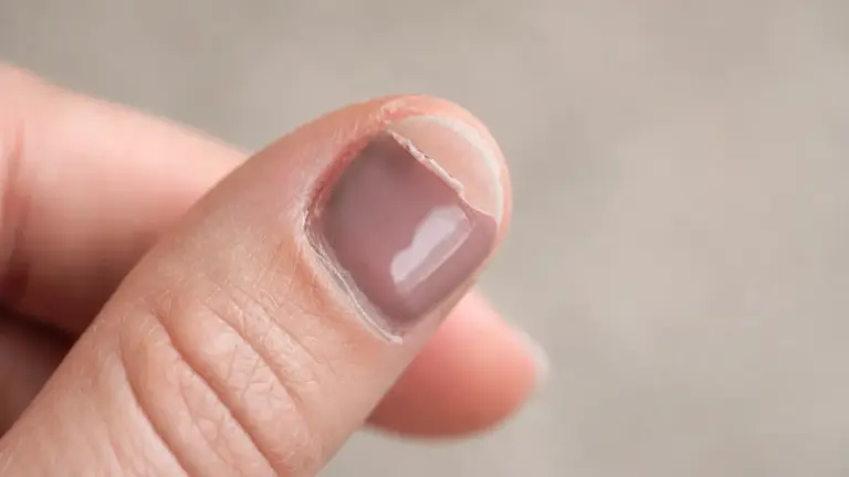 Vernis semi-permanent qui se décolle sur un ongle